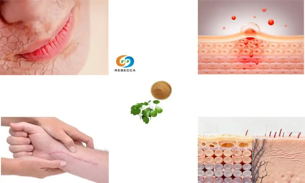 Why is centella asiatica extract powder?